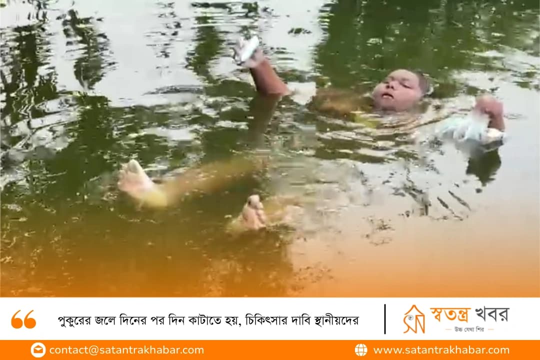 পুকুরের জলে দিনের পর দিন কাটাতে হয়, চিকিৎসার দাবি স্থানীয়দের