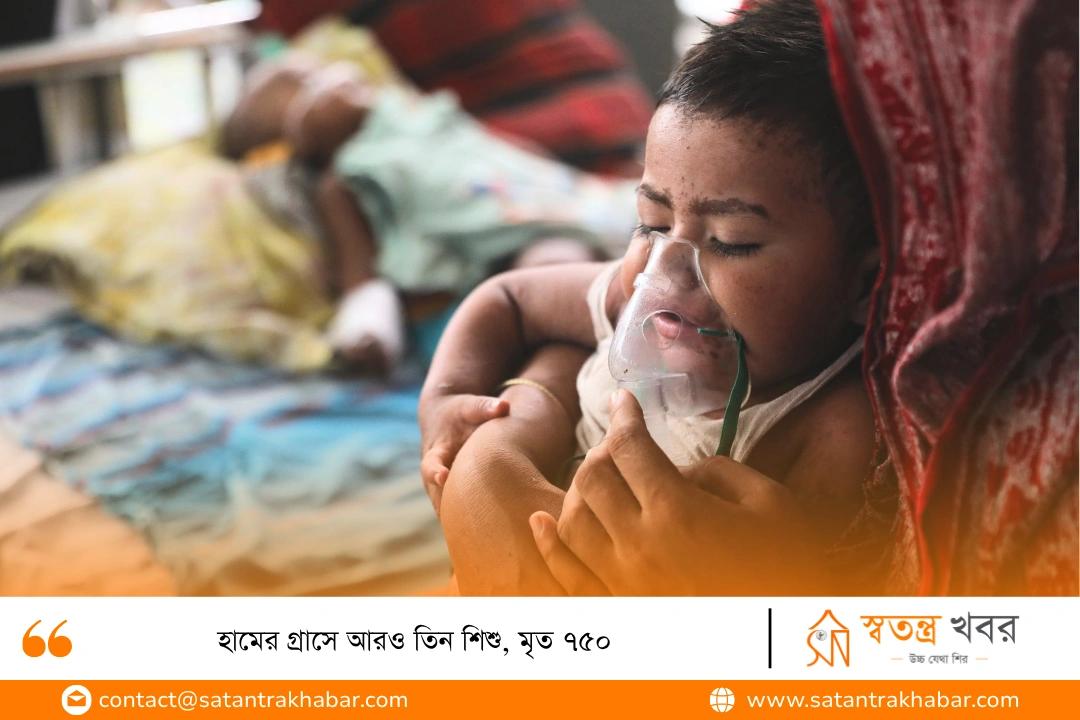 হামের গ্রাসে আরও তিন শিশু, মৃত ৭৫০
