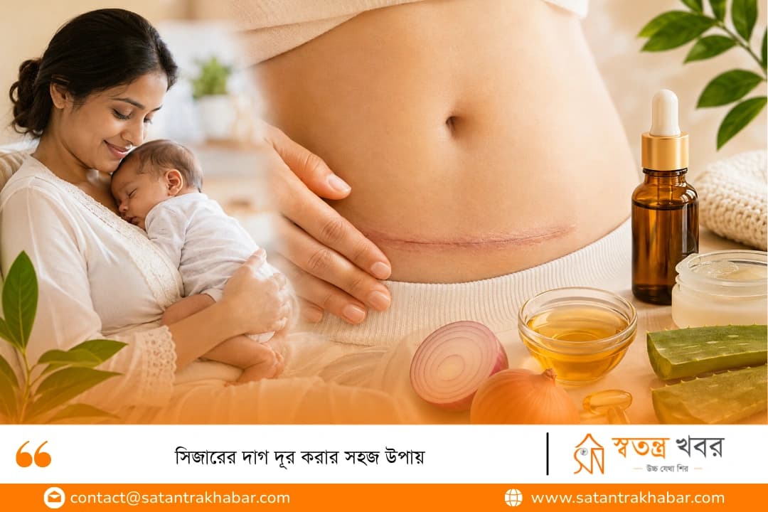 সিজারের দাগ দূর করার সহজ উপায়